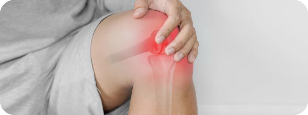 Person holding knee with visible pain and inflammation, illustrating symptoms of an ACL tear such as instability and swelling.