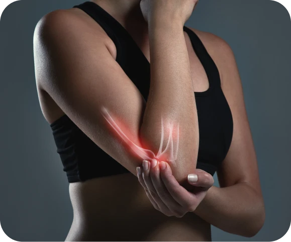 Person holding the back of the arm in pain, highlighting elbow inflammation typical of a distal triceps tendon tear, showing the location of tendon injury