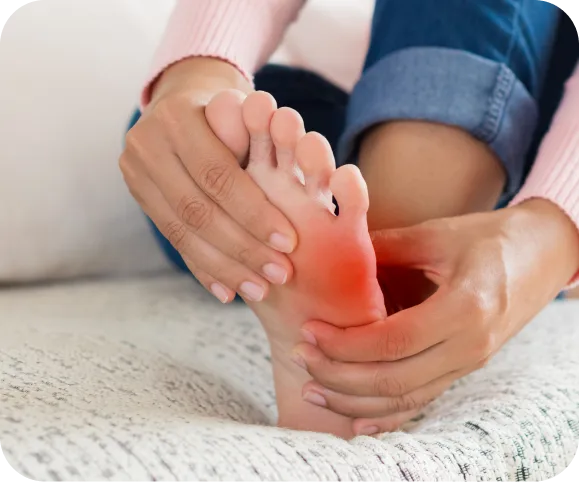 Close-up of a person holding the outer side of their foot with redness and pain, illustrating symptoms of a proximal 5th metatarsal fracture