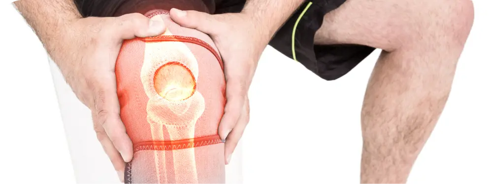 Illustration of knee pain and meniscus damage, showing joint stress relevant to the history and benefits of the circumferential meniscus stitch