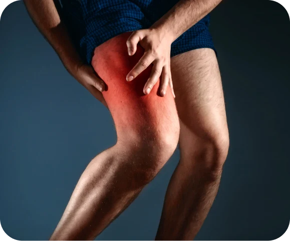 Person holding the outer side of the thigh showing pain and redness caused by chronic distal IT band syndrome