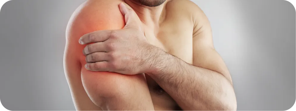 Man holding upper arm with visible shoulder pain, illustrating symptoms of pectoralis tendon rupture
